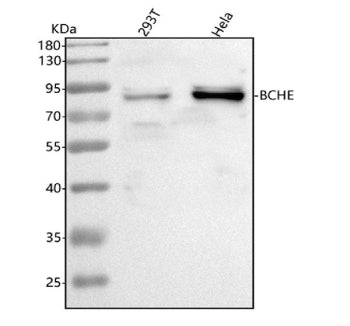 Western blot analysis of BCHE using anti-BCHE antibody. Lane 1: human 293T whole cell lysates, Lane 2: human Hela whole cell lysates. After electrophoresis, proteins were transferred to a nitrocellulose membrane at 150 mA for 50-90 min. Blocked the membrane with 5% non-fat milk/TBS for 1.5 hour at RT.