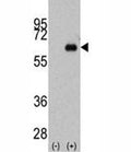Western blot analysis of anti-Myc antibody and 293 cell lysate (2 ug/lane) either nontransfected (Lane 1) or transiently transfected with the MYC gene (2).