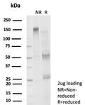 SDS-PAGE analysis of purified, BSA-free FOXP4 antibody (clone PCRP-FOXP4-1A10) as confirmation of integrity and purity.