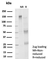 SDS-PAGE analysis of purified, BSA-free FOXP4 antibody (clone PCRP-FOXP4-1A10) as confirmation of integrity and purity.