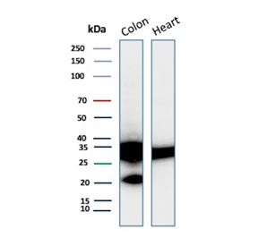 Western blot testing of human colon and heart tissue lysate with recombinant Galectin 3 antibody (clone LGALS3/13208R). Predicted molecular weight ~26 kDa.