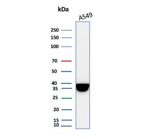 Western blot testing of human A549 cell lysate with recombinant Annexin A1 antibody. Predicted molecular weight ~38 kDa.