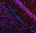 Immunofluorescent staining of MECP2 using anti-MECP2 antibody (red). MECP2 was detected in a paraffin-embedded section of mouse brain tissue. Heat mediated antigen retrieval was performed in EDTA buffer (pH 8.0, epitope retrieval solution). The tissue section was blocked with 10% goat serum. The tissue section was then incubated with 5 ug/ml rabbit anti-MECP2 antibody overnight at 4oC. Cy3 Conjugated Goat Anti-Rabbit IgG was used as secondary antibody at 1:500 dilution and incubated for 30 min at 37oC.