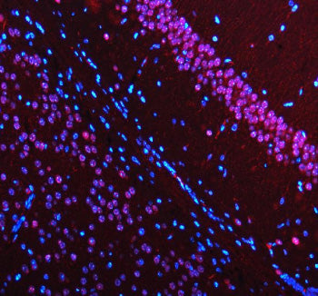 Immunofluorescent staining of MECP2 using anti-MECP2 antibody (red). MECP2 was detected in a paraffin-embedded section of mouse brain tissue. Heat mediated antigen retrieval was performed in EDTA buffer (pH 8.0, epitope retrieval solution). The tissue section was blocked with 10% goat serum. The tissue section was then incubated with 5 ug/ml rabbit anti-MECP2 antibody overnight at 4oC. Cy3 Conjugated Goat Anti-Rabbit IgG was used as secondary antibody at 1:500 dilution and incubated for 30 min at 37oC.