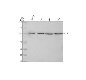 Western blot analysis of STOX2 using anti-STOX2 antibody. Lane 1: human SH-SY5Y whole cell lysates, Lane 2: human Hela whole cell lysates, Lane 3: human 293T whole cell lysates, Lane 4: human RT4 whole cell lysates. After electrophoresis, proteins were transferred to a nitrocellulose membrane at 150 mA for 50-90 min. Blocked the membrane with 5% non-fat milk/TBS for 1.5 hour at RT.