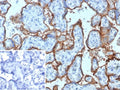 IHC staining of FFPE human placental tissue with CD168 / HMMR antibody (clone HMMR/8021). Inset: PBS used in place of primary Ab (secondary Ab negative control). HIER: boil tissue sections in pH 9 10mM Tris with 1mM EDTA for 20 min and allow to cool before testing.