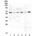 Western blot testing of human 1) U-87 MG, 2) SHG-44, 3) MDA-MB-231, 4) K562, 5) rat C6 and 6) mouse smooth muscle (intestine) lysate. Predicted molecular weight ~75 kDa, observed here at ~62 kDa.
