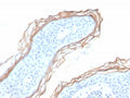 IHC staining of FFPE human skin tissue with Kallikrein 5 antibody (clone KLK5/3855). HIER: boil tissue sections in pH 9 10mM Tris with 1mM EDTA for 20 min and allow to cool before testing.