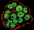 Confocal immunofluorescent analysis of phospho CDX2 antibody and WiDr cells followed by Alexa Fluor 488-conjugated goat anti-rabbit lgG (green). Actin filaments have been labeled with Alexa Fluor 555 Phalloidin (red).