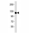 Western blot testing of CSF1R antibodyat 1:4000 dilution + U-87MG lysate; Predicted molecular weight: 106-116 kDa.