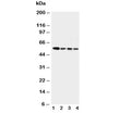 Western blot testing of Caspase-10 antibody and human tumor cell lysates 1: COLO320; 2: HeLa; 3: SW620; 4: Raji.