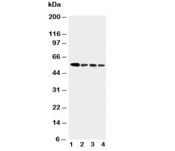 Western blot testing of Caspase-10 antibody and human tumor cell lysates 1: COLO320; 2: HeLa; 3: SW620; 4: Raji.