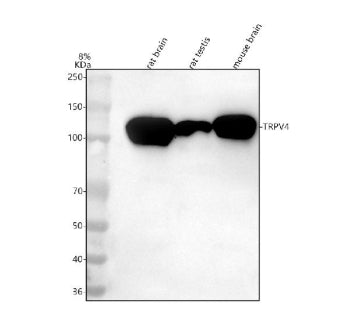 Western blot analysis of TRPV4 using anti-TRPV4 antibody. Lane 1: rat brain tissue lysates, Lane 2: rat testis tissue lysates, Lane 3: mouse brain tissue lysates. After electrophoresis, proteins were transferred to a nitrocellulose membrane at 150 mA for 50-90 min. Blocked the membrane with 5% non-fat milk/TBS for 1.5 hour at RT.