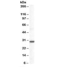 Western blot testing of human lung lysate with DDAH2 antibody at 0.1ug/ml. Predicted molecular weight: ~29 kDa.