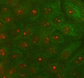 IF analysis of RAD51D using anti-RAD51D antibody (red) and anti-Beta Tubulin antibody (green). RAD51D was detected in immunocytochemical section of cell. Enzyme antigen retrieval was performed using IHC enzyme antigen retrieval reagent for 15 mins. The cells were blocked with 10% goat serum. And then incubated with 5 ug/ml rabbit anti-RAD51D antibody and mouse anti-Beta Tubulin antibody overnight at 4oC.