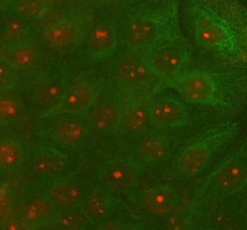 IF analysis of RAD51D using anti-RAD51D antibody (red) and anti-Beta Tubulin antibody (green). RAD51D was detected in immunocytochemical section of cell. Enzyme antigen retrieval was performed using IHC enzyme antigen retrieval reagent for 15 mins. The cells were blocked with 10% goat serum. And then incubated with 5 ug/ml rabbit anti-RAD51D antibody and mouse anti-Beta Tubulin antibody overnight at 4oC.