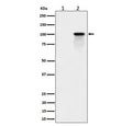 Western blot testing of lysate from human K562 cells, untreated (1) and Calyculin A treated (2), with Phospho-Nucleolin antibody.