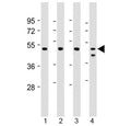 Western blot testing of human 1) Jurkat, 2) U-2 0S, 3) HeLa and 4) MCF7 cell lysate with PSMC2 antibody at 1:2000. Predicted molecular weight ~49 kDa.