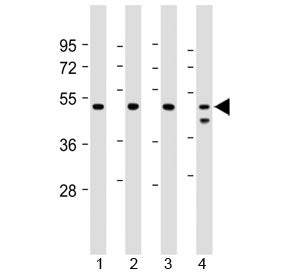 Western blot testing of human 1) Jurkat, 2) U-2 0S, 3) HeLa and 4) MCF7 cell lysate with PSMC2 antibody at 1:2000. Predicted molecular weight ~49 kDa.