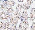 IHC testing of FFPE human placental tissue with EHD2 antibody. HIER: steam section in pH9 EDTA for 20 min and allow to cool prior to staining.