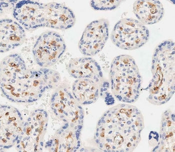 IHC testing of FFPE human placental tissue with EHD2 antibody. HIER: steam section in pH9 EDTA for 20 min and allow to cool prior to staining.