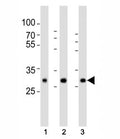 Western blot analysis of lysate from human (1) placenta, (2) lung, (3) kidney tissue lysate using SOD3 antibody at 1:1000. Predicted molecular weight: 26~32 kDa.