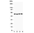 Western blot testing of Cyclin B1 antibody and Lane 1: HeLa; 2: 293T; 3: MCF-7; 4: COLO320 lysate. Predicted molecular weight: 48-60 kDa.