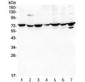 Western blot testing of human 1) A431, 2) K562, 3) A549, 4) PC-3, 5) U-2 OS, 6) Caco-2 and 7) HEK293 lysate with DARS2 antibody at 0.5ug/ml. Predicted molecular weight ~74 kDa.