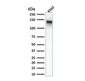 Western blot testing of human K562 cell lysate with recombinant CD43 antibody (clone rSPN/839). Expected molecular weight: 45-135 kDa depending on glycosylation level.