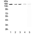 Western blot testing of 1) human A549, 2( (h) SK-OV-3, 3) (h) PANC-1, 4) rat brain and 5) mouse brain lysate with IRE1 antibody at 0.5ug/ml. Predicted molecular weight ~110 kDa, observed here at ~170 kDa.