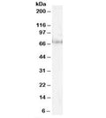 Western blot testing of HeLa lysate with Pescadillo antibody at 1ug/ml. Predicted/observed molecular weight: ~68kDa.