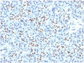 IHC staining of FFPE human pancreatic tissue with SOX9 antibody (clone PCRP-SOX9-1A2). HIER: boil tissue sections in pH 9 10mM Tris with 1mM EDTA for 20 min and allow to cool before testing.