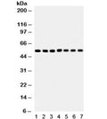 Western blot testing of 1) rat heart, 2) mouse heart, 3) rat skeletal muscle, 4) mouse skeletal muscle, 5) 293, 6) MCF7 and 7) HeLa lysate with SMAD antibody. Expected molecular weight of SMADs 1-5: 48~60 kDa, observed here at ~52 kDa.