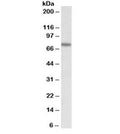 Western blot testing of NIH3T3 lysate with KEAP1 antibody at 0.2ug/ml. Predicted molecular weight ~70 kDa.