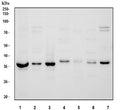 Western blot testing of 1) human K562, 2) human HeLa, 3) human Jurkat, 4) rat brain, 5) rat spleen, 6) mouse brain and 7) mouse spleen tissue lysate with DNA polymerase beta antibody. Predicted molecular weight ~38 kDa.