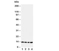Western blot testing of Stefin B antibody; Lane 1: A549; 2: A431; 3: COLO320; 4: HeLa cell lysate. Predicted/observed molecular weight: ~11kDa.