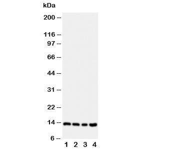 Western blot testing of Stefin B antibody; Lane 1: A549; 2: A431; 3: COLO320; 4: HeLa cell lysate. Predicted/observed molecular weight: ~11kDa.