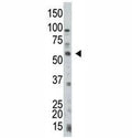 PTEN antibody used in western blot to detect PTEN in HL-60 cell lysate