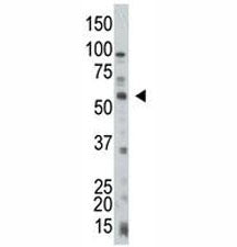 PTEN antibody used in western blot to detect PTEN in HL-60 cell lysate
