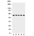 Western blot testing of ASIC3 antibody and Lane 1: rat brain; 2: (r) testis; 3: human U87; 4: mouse Neuro-2a; 5: (h) SMMC-7721 cell lysate. Expected/observed molecular weight: ~59 kDa.