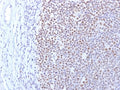 IHC staining of FFPE human tonsil with DNMT1 antibody. HIER: boil tissue sections in pH 9 10mM Tris with 1mM EDTA for 10-20 min and allow to cool before testing.