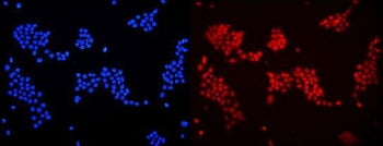Immunofluorescent staining of FFPE human A431 cells with DDB1 antibody (red) and DAPI nuclear stain (blue). HIER: steam section in pH6 citrate buffer for 20 min.