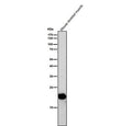 All lanes use the antibody at 1:1K dilution for 1 hour at room temperature. Predicted molecular weight ~18 kDa.
