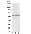 Western blot testing of Daudi [A], Jurkat [B] and HepG2 [C] lysates with DDX6 antibody at 0.3ug/ml. Predicted molecular weight: ~53kDa.