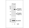 Western blot testing of lysate from normal rat heart tissue and spontaneous hypertensive (SHR) rat heart tissue, using Phospho-PLB antibody.