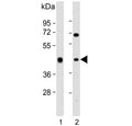 Western blot testing of human 1) liver and 2) Jurkat cell lysate with ADH1B antibody. Predicted molecular weight ~40 kDa.