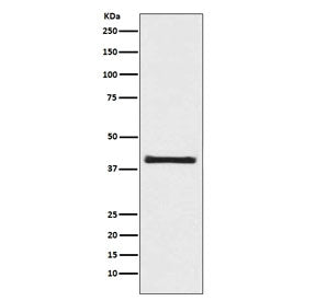 Western blot testing of human 293T cell lysate with AKT1S1 antibody. Expected molecular weight ~40 kDa.