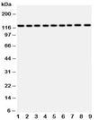 Western blot testing of TRPC3 antibody and Lane 1: rat liver; 2: (r) lung; 3: (r) intestine; 4: (r) ovary; 5: human U87; 6: (h) A549; 7: (h) COLO320; 8: (h) SW620; 9: (h) HeLa lysate. Predicted molecular weight ~96/106/97 kDa (isoforms 1/2/3), observed here at ~120 kDa.