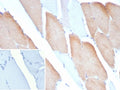 IHC staining of FFPE human skeletal muscle tissue with MYH7 antibody (clone MYH7/9183). Inset: PBS used in place of primary Ab (secondary Ab negative control).