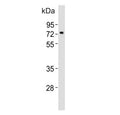 Western blot testing of mouse pancreas tissue lysate with Nr4a2 antibody. Predicted molecular weight ~67 kDa.
